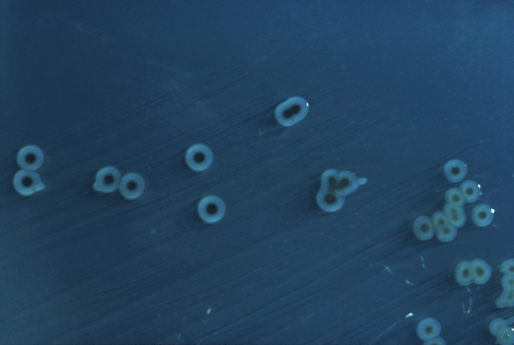 Salmonella enterica serovar typhimurium.jpg
