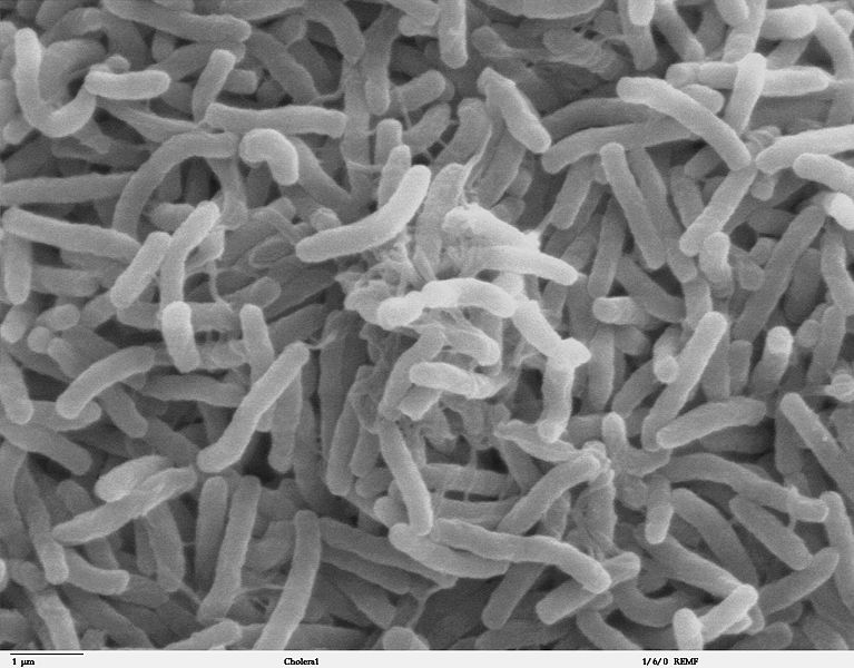 File:767px-Cholera bacteria SEM.jpg