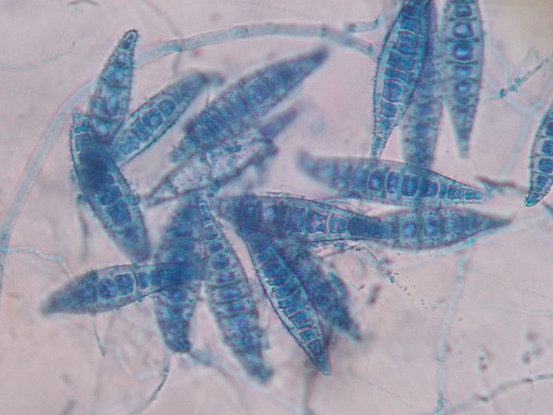File:M. canis macroconidia from wiki.jpg