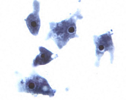 Naegleria fowleri trophozoites.jpg