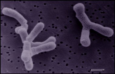 File:Bifidobacterium.jpg .jpg