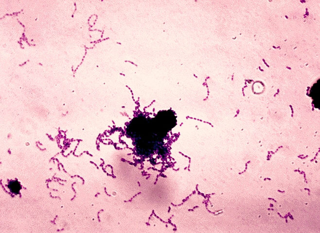 File:Streptococcus mutans 01.jpg