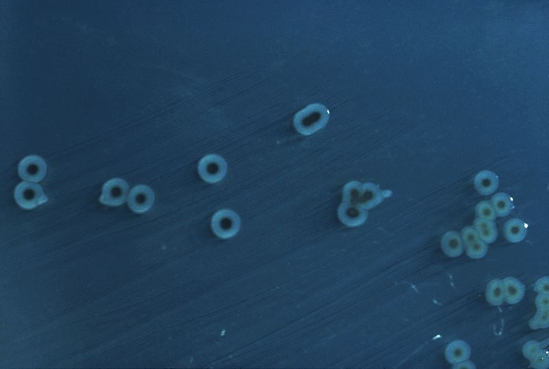 File:Salmonella enterica serovar typhimurium.jpg