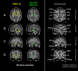 CO2-O2-fMRI-all.png