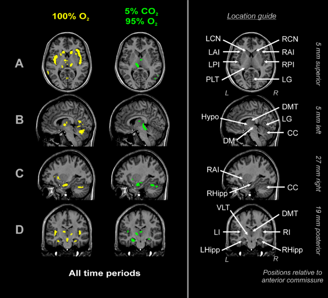 File:CO2-O2-fMRI-all.png