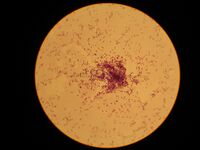 Streptococcus lactis.jpg