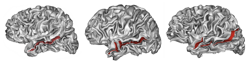 File:Brain-variability-STS-horizontal.png