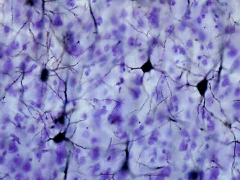 File:Macaca somatosensory cortex Golgi Brainmaps.org.png