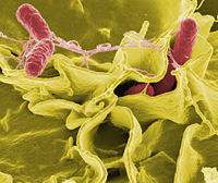 Salmonella typhimurium.jpg